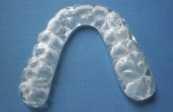 Går utmärkt att använda i väntan på implantat. Kan göras i mindre sektioner. Syns inte i munnen. Kan användas i kombination med metallskelett. FLEXIBLE PARTIALS MED METALL Sunfl ex /Cr.
