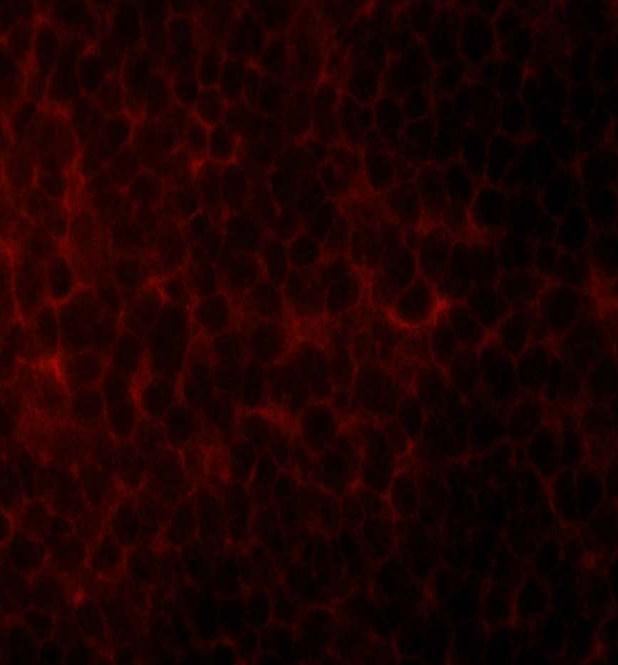 A) staining with Mab 2C2 shows distinct intracellular pattern.