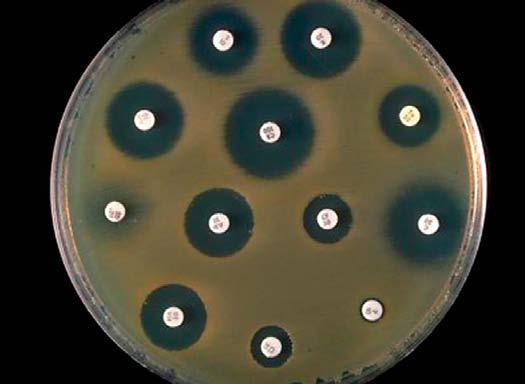 30 Undersøgelse af bakteriers resistens overfor forskellige antibiotika.