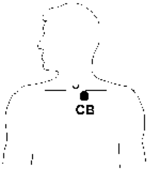 let at forstå. Det er forkortet Ch for Chin. Punktet hvor sternum (brystbenet), kravebenet og første ribben mødes.
