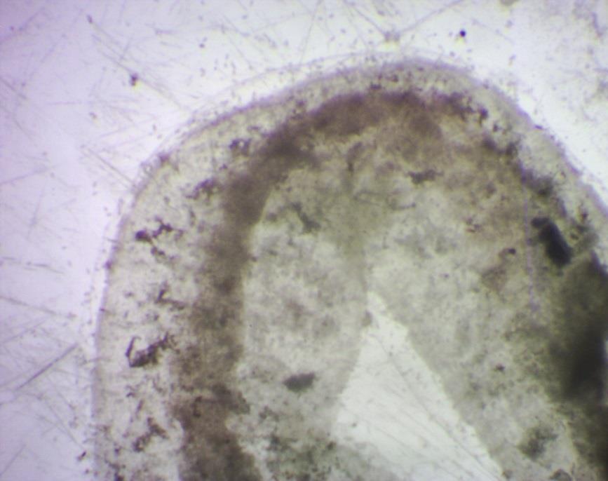 Analyse af ormene Fra mikroskopiske