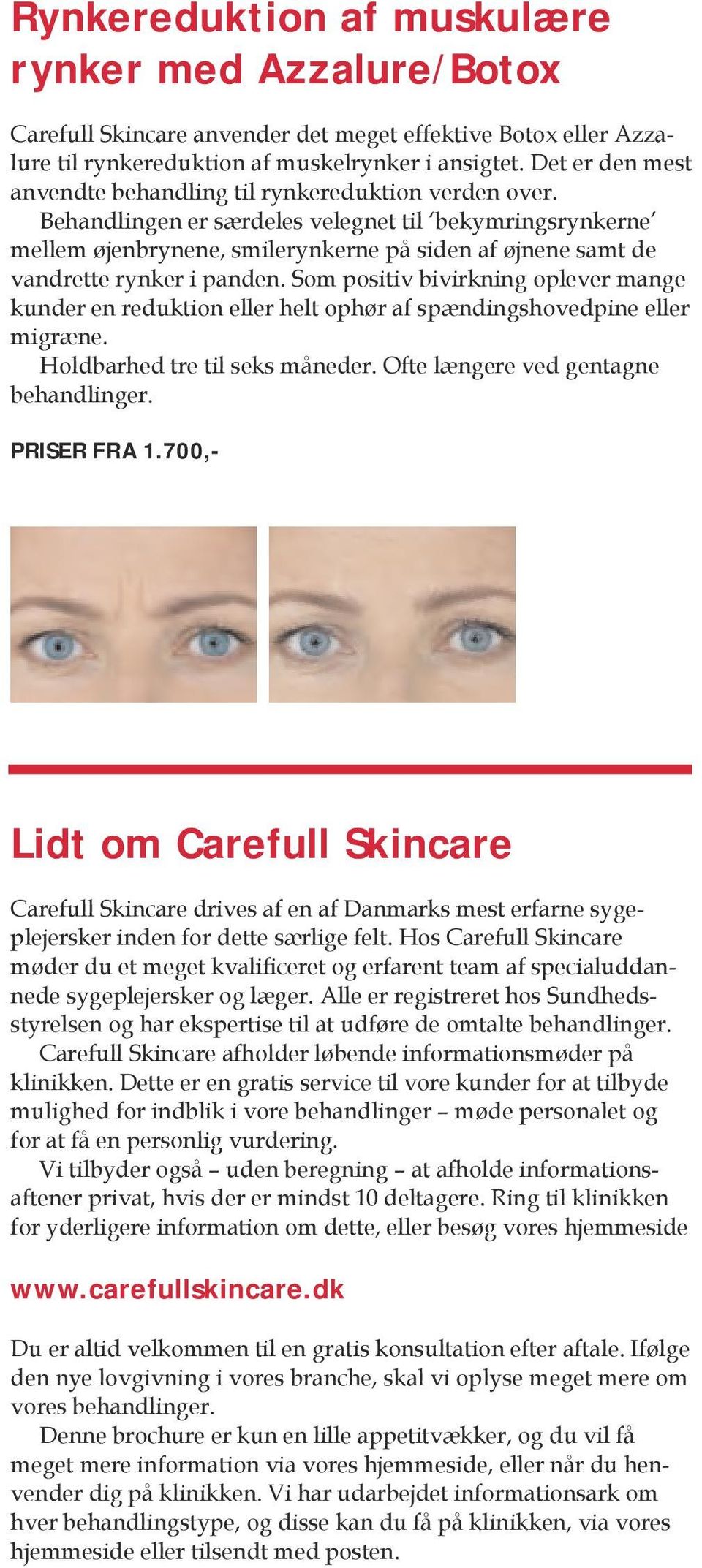 Behandlingen er særdeles velegnet til bekymringsrynkerne mellem øjenbrynene, smilerynkerne på siden af øjnene samt de vandrette rynker i panden.