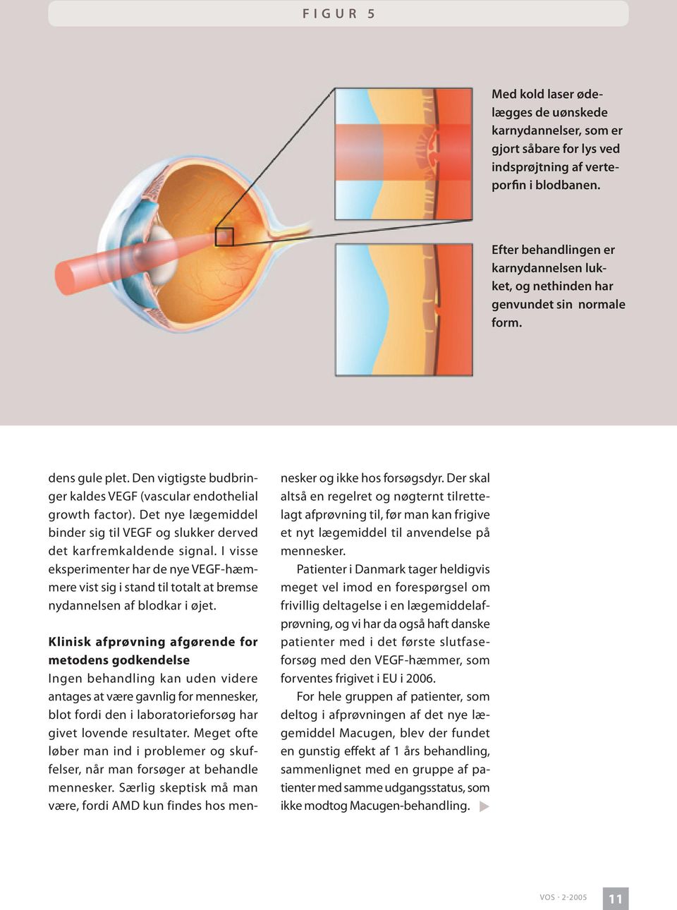 Det nye lægemiddel binder sig til VEGF og slukker derved det karfremkaldende signal. I visse eksperimenter har de nye VEGF-hæmmere vist sig i stand til totalt at bremse nydannelsen af blodkar i øjet.