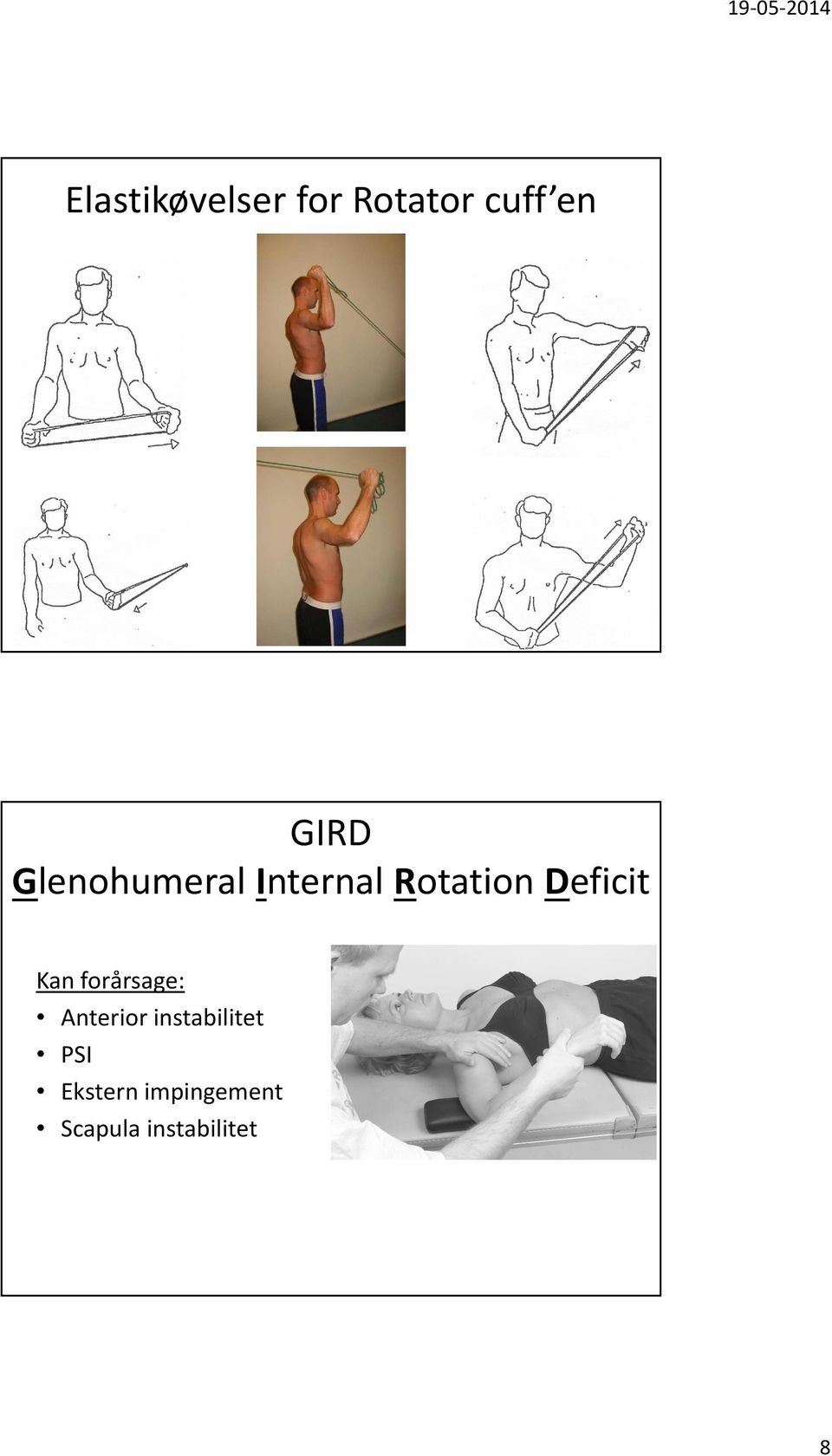 Rheinlænder, Fysioterapeut GIRD Glenohumeral Internal Rotation