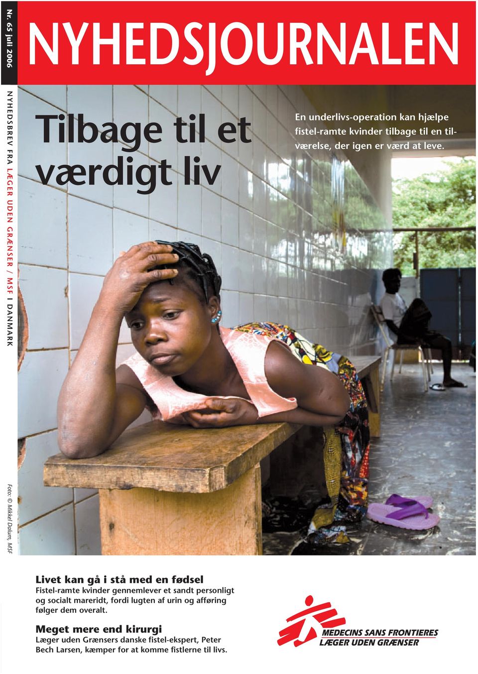 Foto: Mikkel Dalum, MSF Livet kan gå i stå med en fødsel Fistel-ramte kvinder gennemlever et sandt personligt og socialt mareridt,