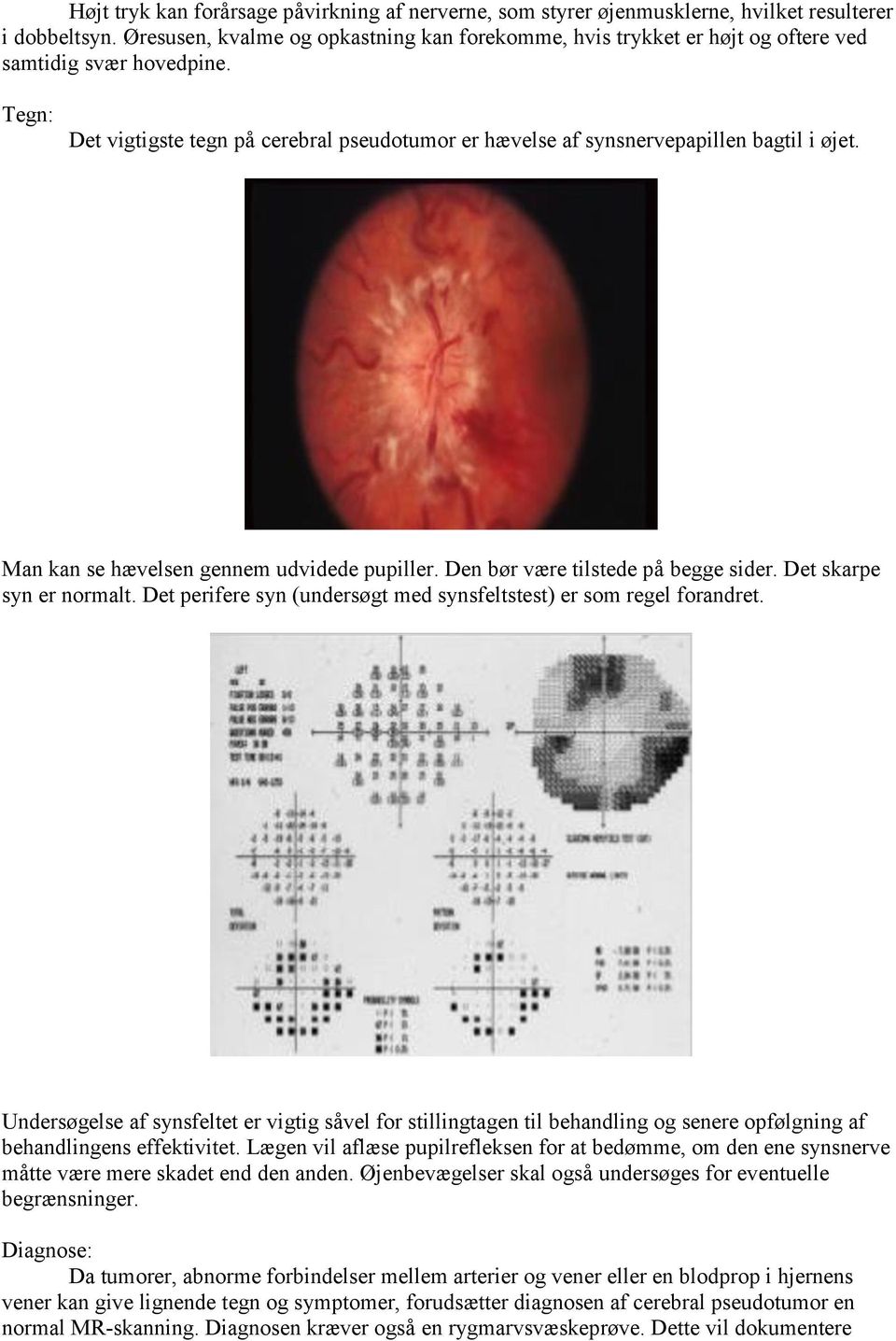 Tegn: Det vigtigste tegn på cerebral pseudotumor er hævelse af synsnervepapillen bagtil i øjet. Man kan se hævelsen gennem udvidede pupiller. Den bør være tilstede på begge sider.
