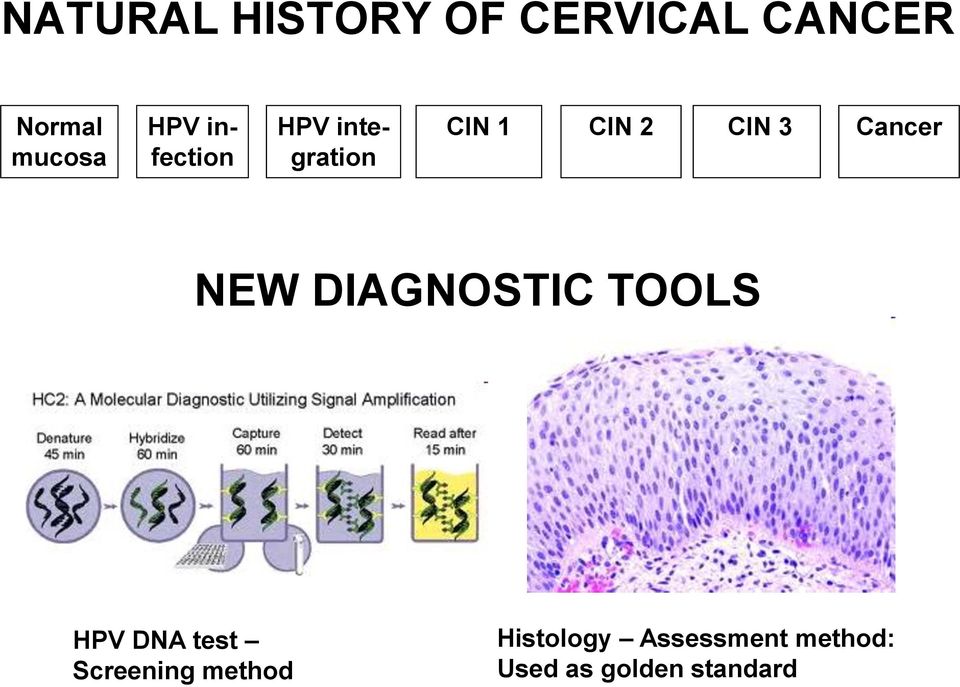 Cancer NEW DIAGNOSTIC TOOLS HPV DNA test Screening
