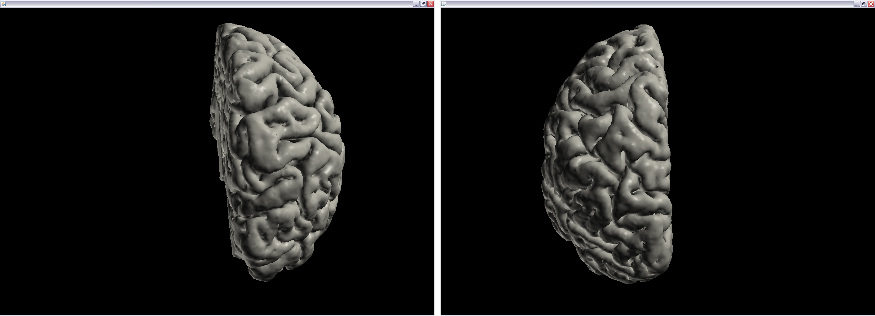 9.6 Visualisering af cortexmodeller På figur 9.8 ses en visualisering af hele cortex cerebri og på figur 9.9 ses, en visning af de enkelte hemisfærer for cortex cerebri. Figur 9.