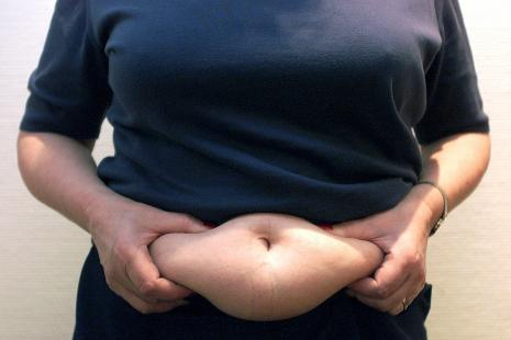 Dårlige prognoser for bekæmpelse af fedmeepidemien DR 19.7.