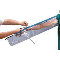 Urias splint Urias splints giver et jævnt tryk på arm, ben, hånd og fod. Splintsne er fremstillet i dobbelt lag PVC og lukkes med glidelås.