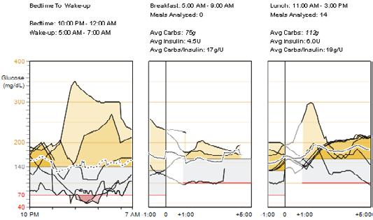 Glucose Sensor Overlay Bedtime to Wake-up and Meal Periods Readings and Averages (glukosesensor-overlæg sengetid til opvågning og måltidsperioder målinger og gennemsnit) Følgende konventioner