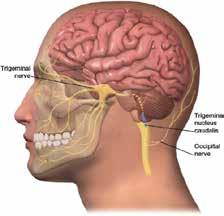 Nu viser det sig, at 24 migrænikere med forholdsvis få dage (18 dage om året) har mindre hjernebark i hjernestammen end tilsvarende kontrolpersoner.