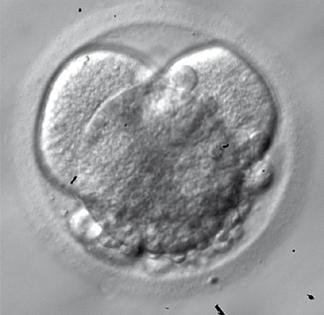 Figur 7 viser et pænt embryon således som det kan se ud på 3. dagen, hvor det består af 8 celler. På figuren ses også et embryon, der er dyrket i laboratoriet i 5 dage.