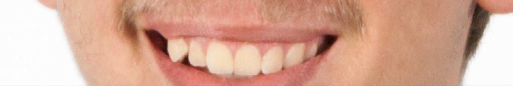 tænderne: Processen med Clone Stamp