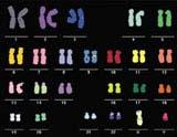 Et menneske har 23 kromosom-par Hvert kromosom-par