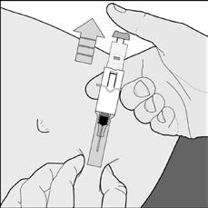 F). Figur F Injektionssprøjte med manuelt beskyttelsessystem af nålen 9.