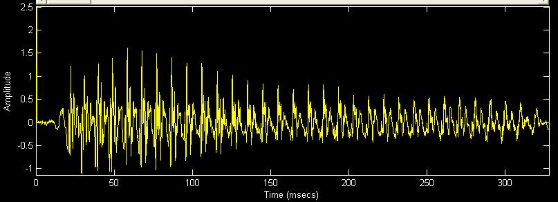 Power Spectrum Magnitude (db) DSP Signaler kan repræsenteres i 2 domæner: Tids domænet