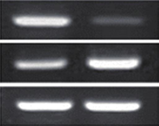 and 14-3-3 Sigma in Breast Cancer 9 Densitometric scanning RT-PCR Actin Control si Densitometry of band 1 MCF-7 si * * Western blot Control si A 1 1 MCF-7 si * B Actin Densitometry of band * C D