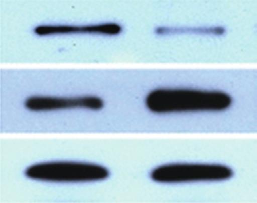 After transfection, total RNA and whole cell lysates were prepared and subjected to reverse transcription polymerase chain reaction (A) and Western blot (C).