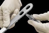 Handle may be placed anywhere along proximal end of retractor, assuming it is a flat surface.
