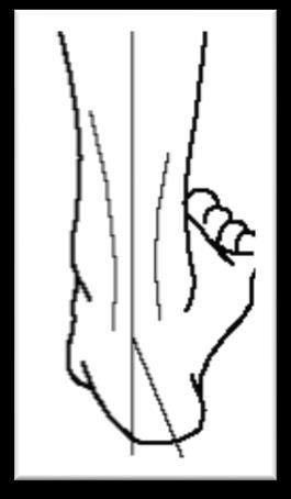 Vurdering af fod