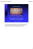 Tandsundhed. Gode kostvaner og grundig, flourtandpasta beskytter tænderne t mod karies og erosionsskader