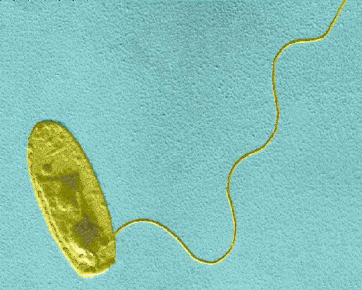 Legionella Små stavformede Gram-negative bakterier (2μm), de fleste med en til to flagellar Der er beskrevet 59 arter (flere kommer til) Hvoraf mindst 18 har været associeret med sygdom hos mennesker