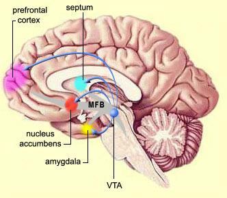 Skizofreni og stofafhængighed Nedsat aktivitet i DLPFC nedsat kognitiv fleksibilitet, anhedoni Hyperaktivt mesolimbiske dopaminsystem forstyrret tilskrivelse af betydning til stimuli Muligvis