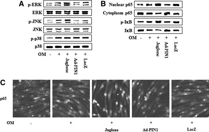626 LEE ET AL. FIG. 9. Effects of the PIN1 inhibitor (juglone) and Ad-PIN1 on MAPK and NF-kB protein levels during odontogenic differentiation in HDPSCs.