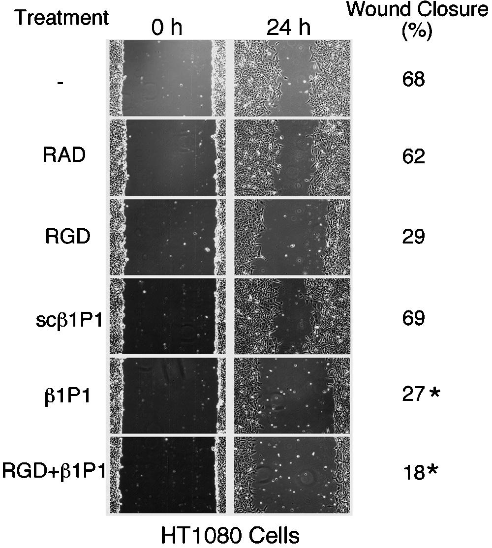 Figure 7. RGD and 1P1 peptides inhibit HT1080 cell wound healing. Serum-starved HT1080 monolayers were wounded and incubated with different peptides (RAD, RGD, sc 1P1, and 1P1; 20 M) in DME/0.1% BSA.
