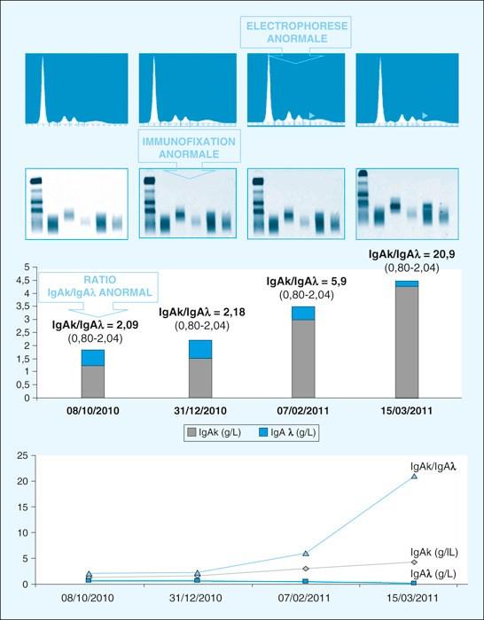 M-komponent analyser ved myelomatose - PDF Free Download
