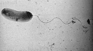1 Introduktion Vibrio cholerae, V. cholerae, er en bakterie, der forårsager diarre-sygdommen, kolera. Denne bakterie blev første gang isoleret i ren kultur i 1884 af Robert Koch. V. cholerae har igennem tiden forårsaget store epidemier, og i mange dele af verden er V.