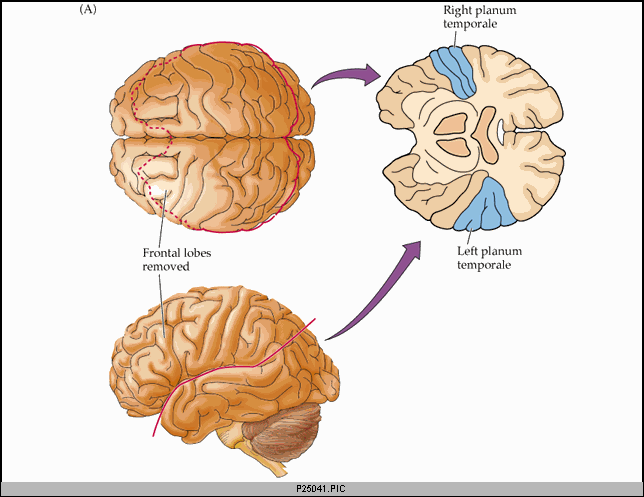 Hjernens anatomi Koncentration, planlægning Spatial information Parietal lobe Frontal lobe Occipital lobe Modtager og integrerer synsindtryk Modtager og integrerer