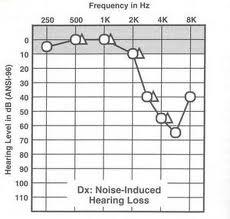I dag er høreapparater jo så små og diskrete, at de næsten ikke ses, og lydkvaliteten er i top. Som medlem af Ældre Sagen får du ekstra fordele, hvis du vælger en Oticon høreløsning.