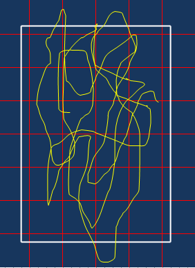 figur 8). De primære bevægelser af COP i stående position finder sted i anterior-posterior retningen (24), hvilket også ses på figur 8.