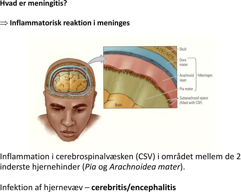 cerebrospinalvæsken (CSV) i området mellem de 2