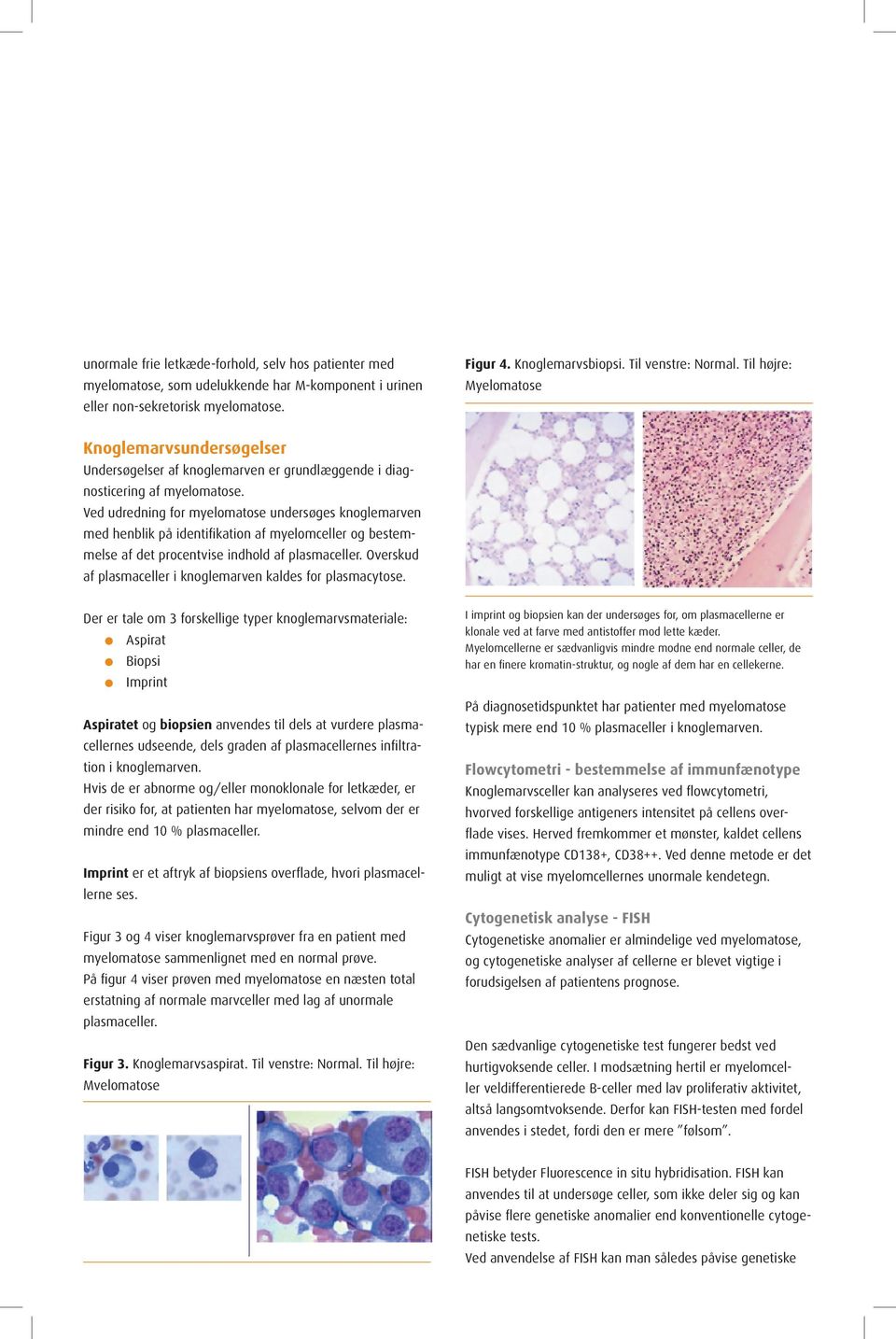 Diagnosticering. sygeplejerske info om myelomatose - PDF Gratis download