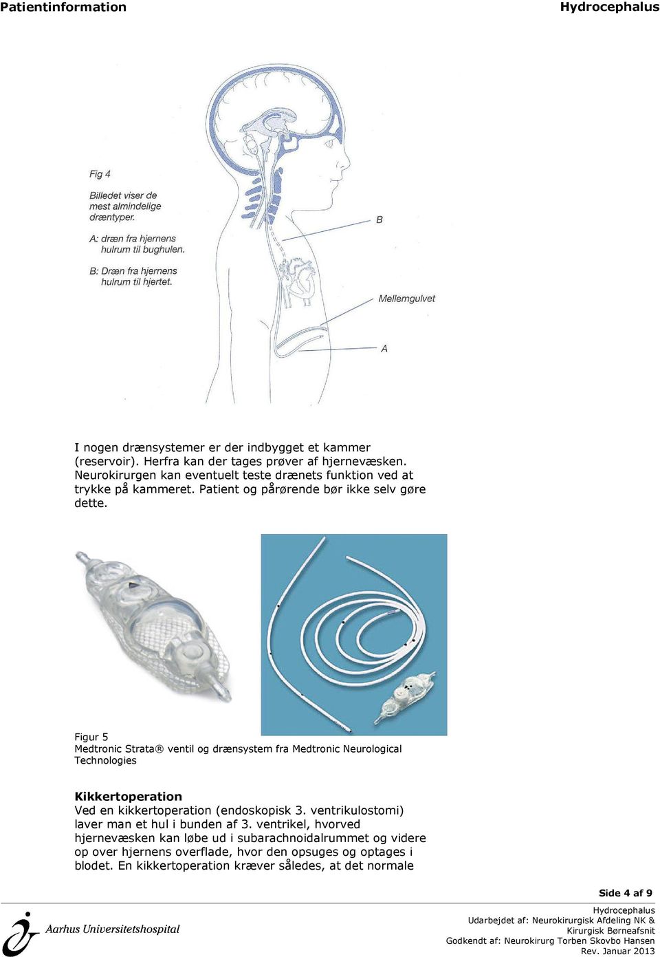 Figur 5 Medtronic Strata ventil og drænsystem fra Medtronic Neurological Technologies Kikkertoperation Ved en kikkertoperation (endoskopisk 3.