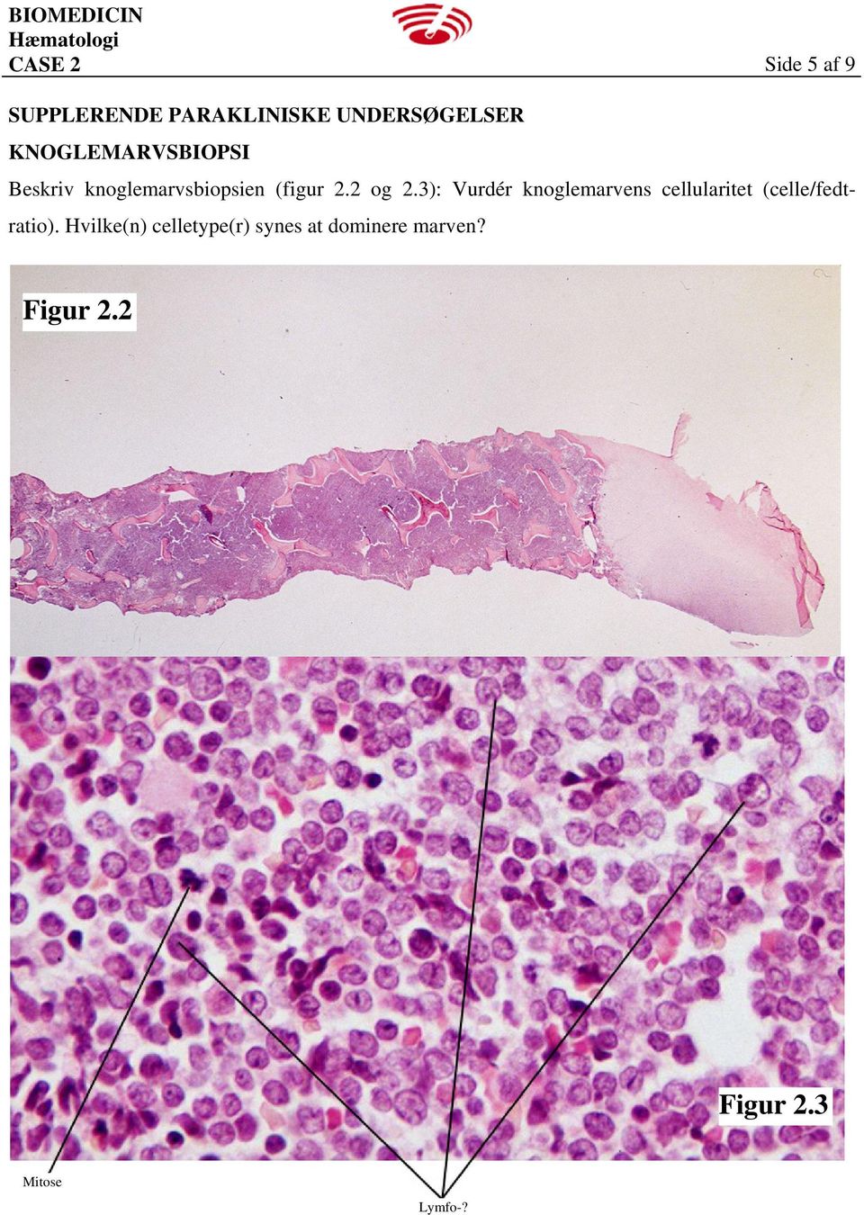 3): Vurdér knoglemarvens cellularitet (celle/fedtratio).