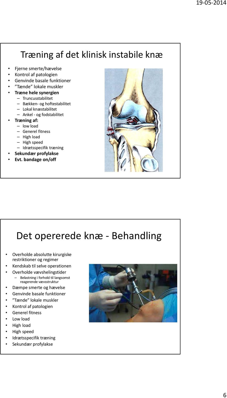 bandage on/off Det opererede knæ - Behandling Overholde absolutte kirurgiske restriktioner og regimer Kendskab til selve operationen Overholde vævshelingstider Belastning i forhold til