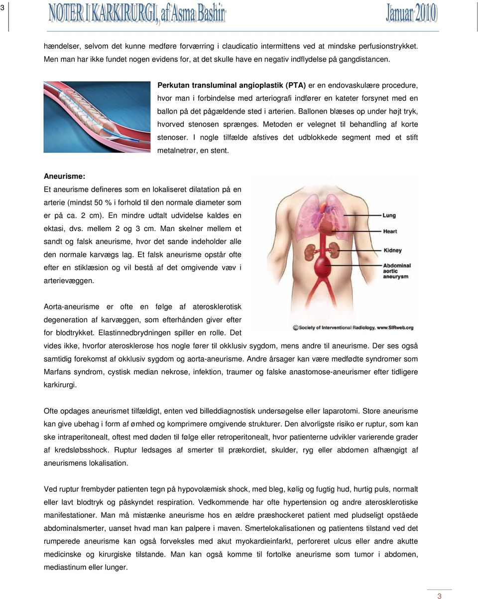 Perkutan transluminal angioplastik (PTA) er en endovaskulære procedure, hvor man i forbindelse med arteriografi indfører en kateter forsynet med en ballon på det pågældende sted i arterien.