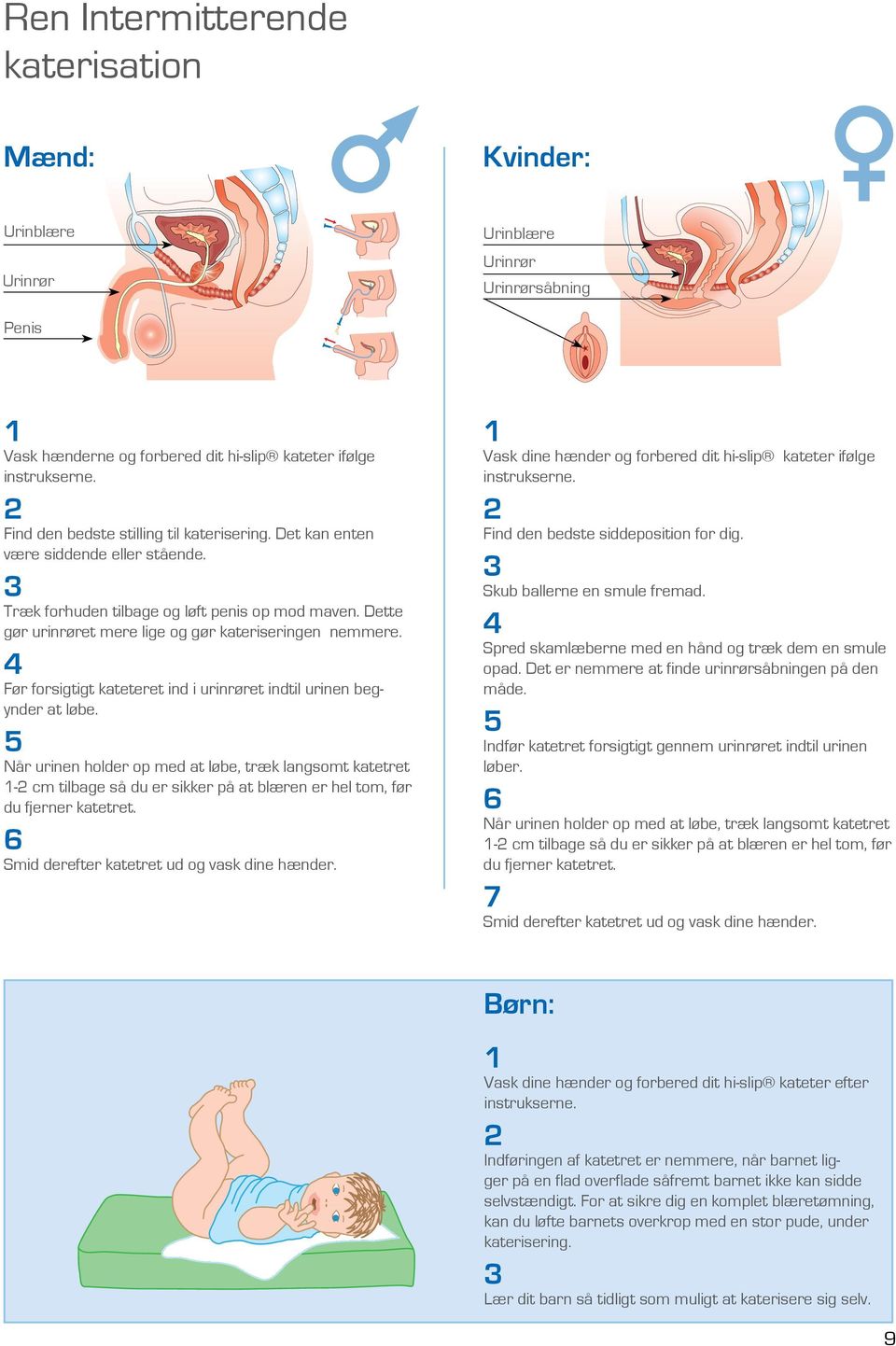 4 Før forsigtigt kateteret ind i urinrøret indtil urinen begynder at løbe.