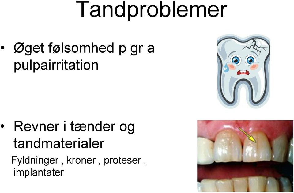 tænder og tandmaterialer
