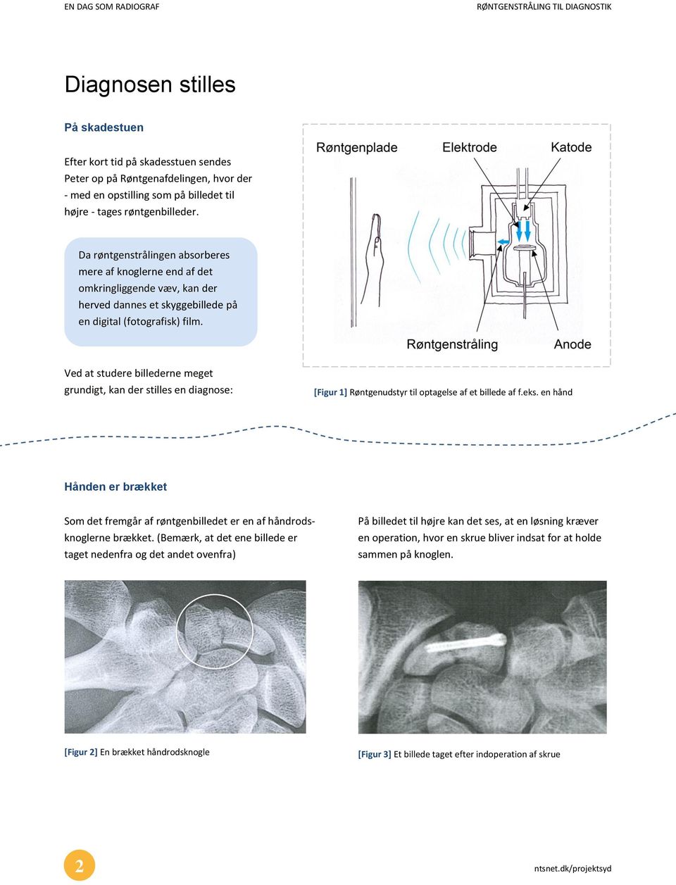 Ved at studere billederne meget grundigt, kan der stilles en diagnose: [Figur 1] Røntgenudstyr til optagelse af et billede af f.eks.