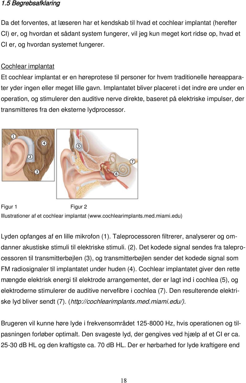 Implantatet bliver placeret i det indre øre under en operation, og stimulerer den auditive nerve direkte, baseret på elektriske impulser, der transmitteres fra den eksterne lydprocessor.