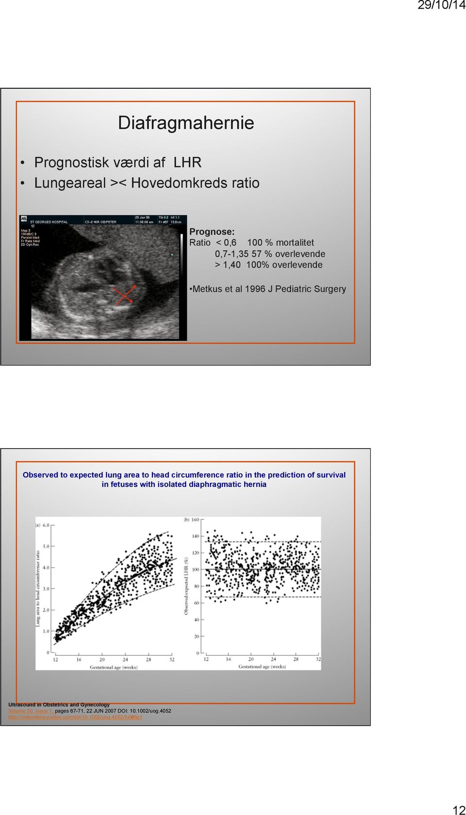 ratio in the prediction of survival in fetuses with isolated diaphragmatic hernia Ultrasound in Obstetrics and Gynecology