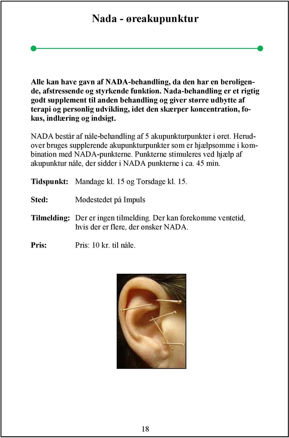 NADA består af nåle-behandling af 5 akupunkturpunkter i øret. Herudover bruges supplerende akupunkturpunkter som er hjælpsomme i kombination med NADA-punkterne.