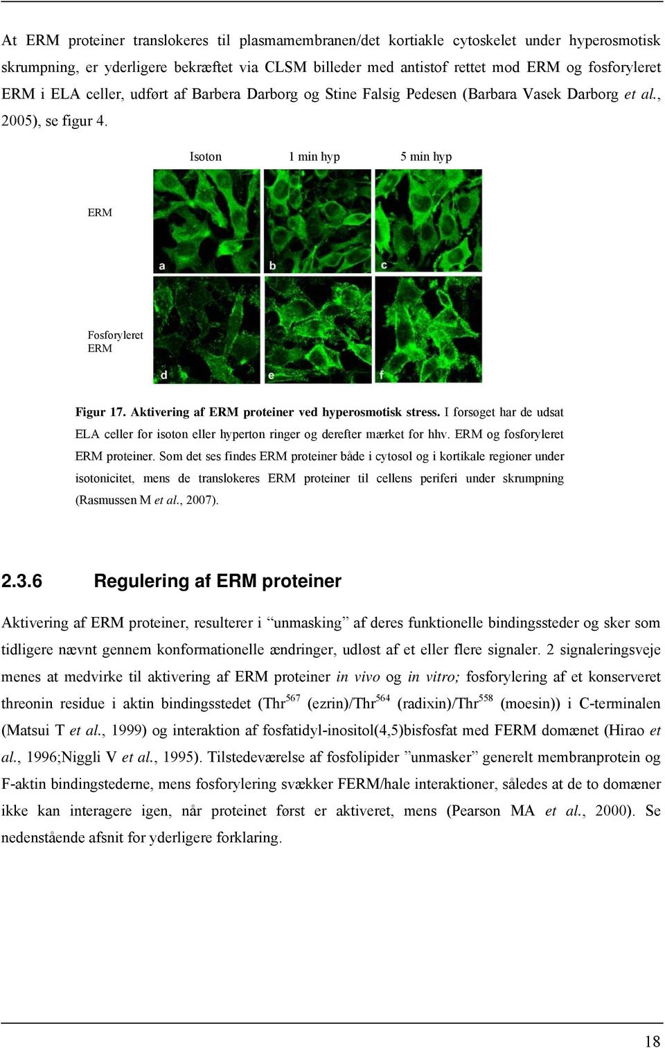 Aktivering af ERM proteiner ved hyperosmotisk stress. I forsøget har de udsat ELA celler for isoton eller hyperton ringer og derefter mærket for hhv. ERM og fosforyleret ERM proteiner.