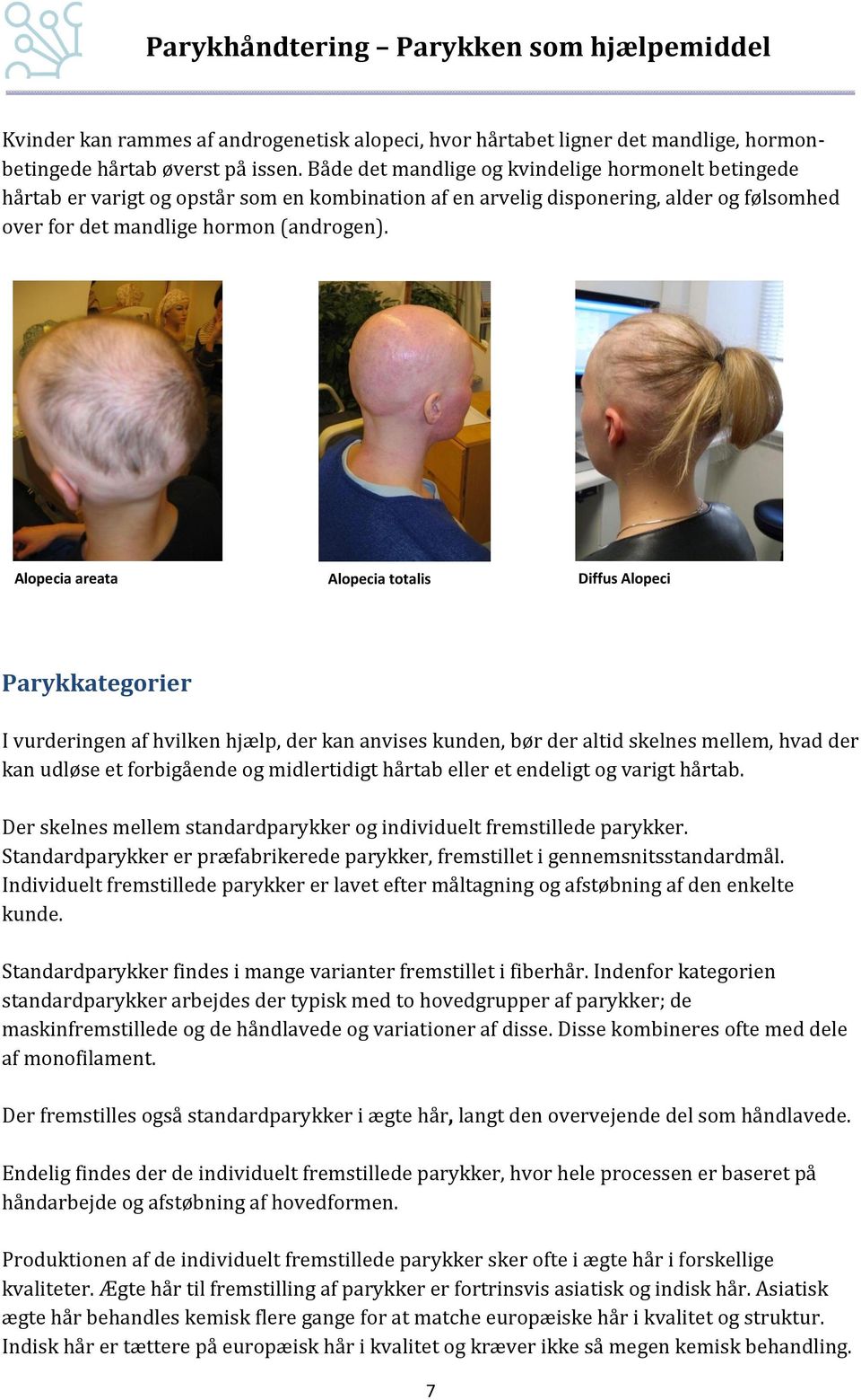 Alopecia areata Alopecia totalis Diffus Alopeci Parykkategorier I vurderingen af hvilken hjælp, der kan anvises kunden, bør der altid skelnes mellem, hvad der kan udløse et forbigående og
