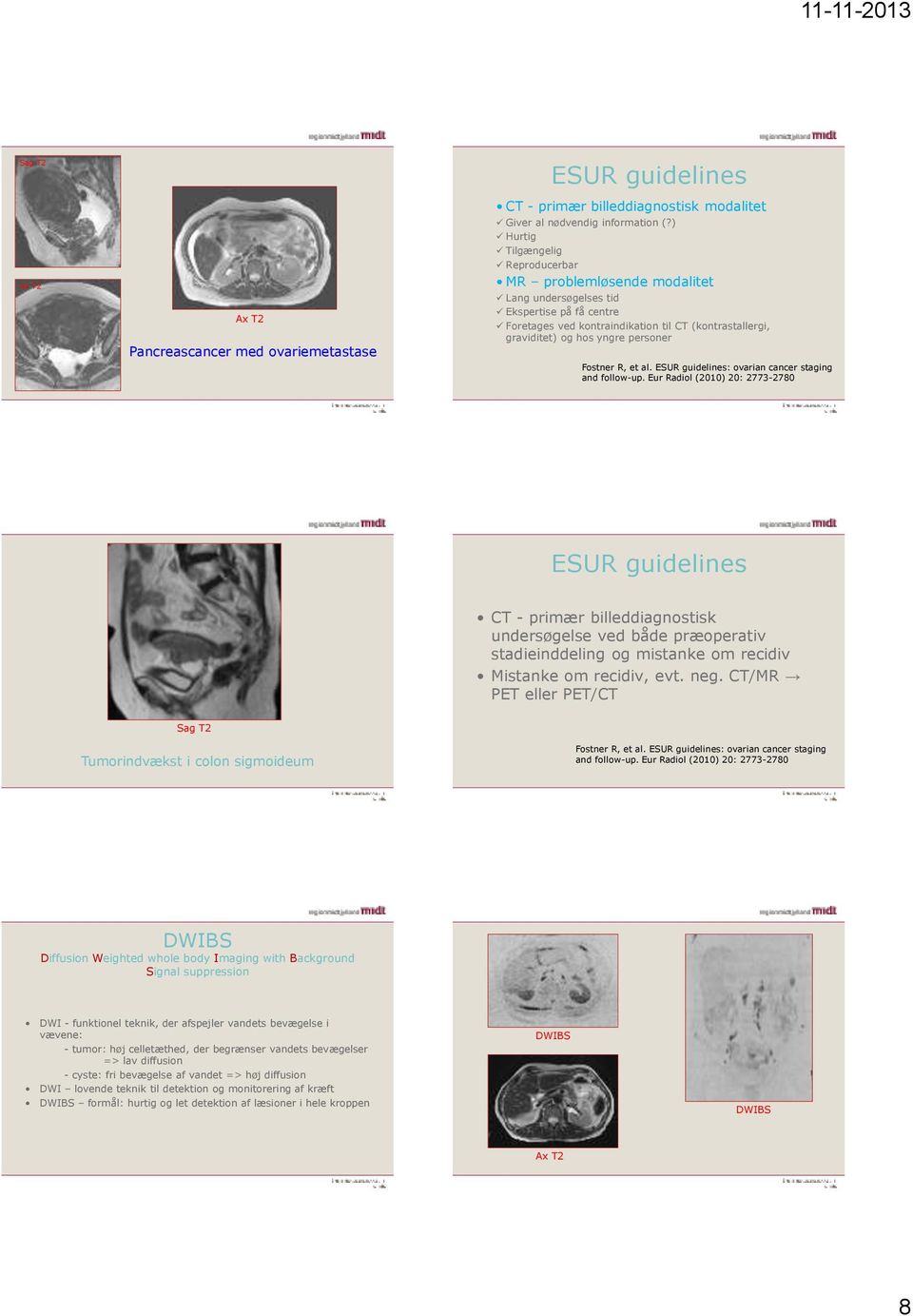 Fostner R, et al. ESUR guidelines: ovarian cancer staging and follow-up.